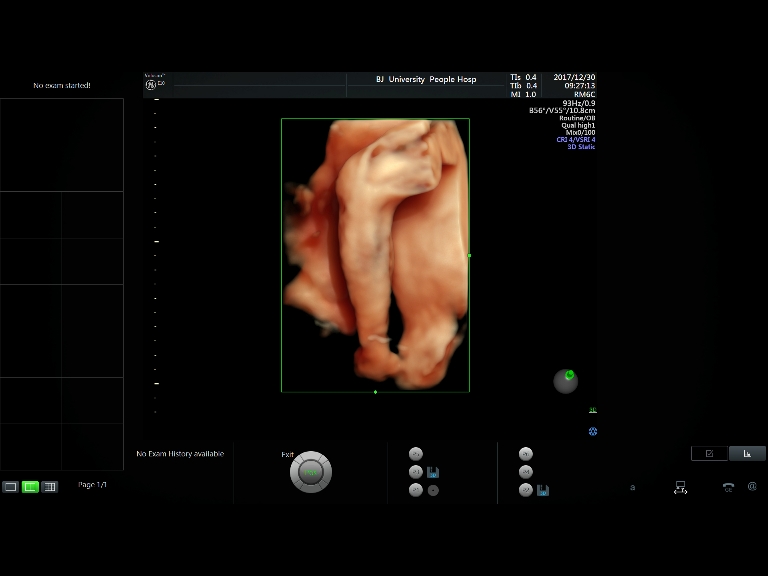 徐州九龙妇产医院四维彩超图片